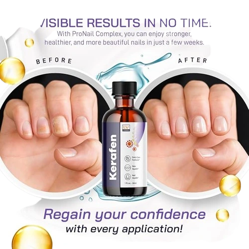 Kerafen Fungus Supplement